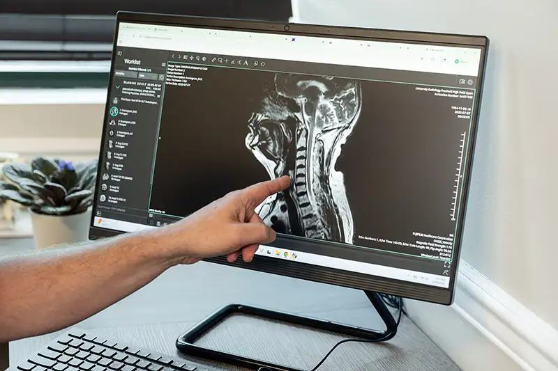 A physician points to spinal X-ray findings, reflecting the diagnostic-first approach to conditions at Shore Spine & Pain.