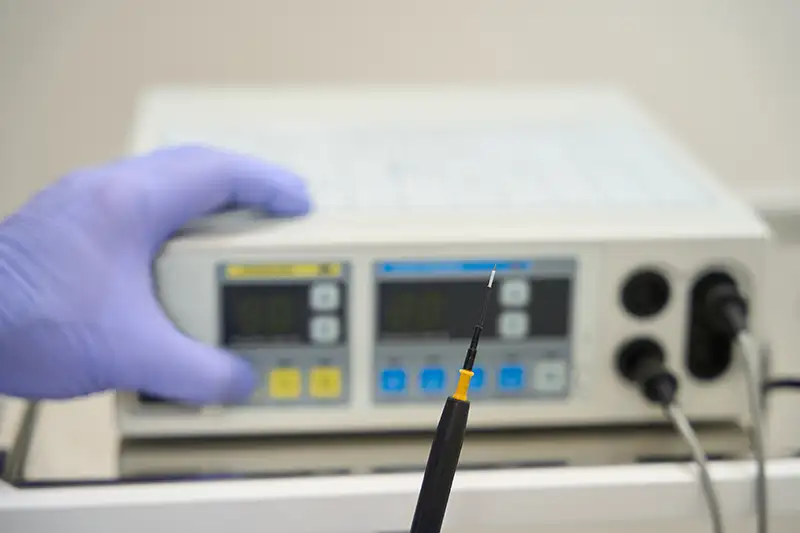 A gloved clinician holding a radiofrequency ablation needle in front of an RF generator unit, illustrating the specialized probe and equipment used to deliver targeted heat energy to pain-generating nerves during radiofrequency ablation at Shore Spine & Pain.