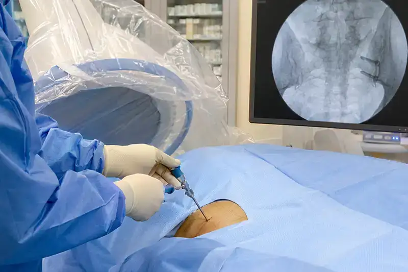 A physician and patient pointing to the lower lumbar and sacropelvic region of an anatomical spine model during a consultation about SI joint arthrodesis at Shore Spine & Pain.