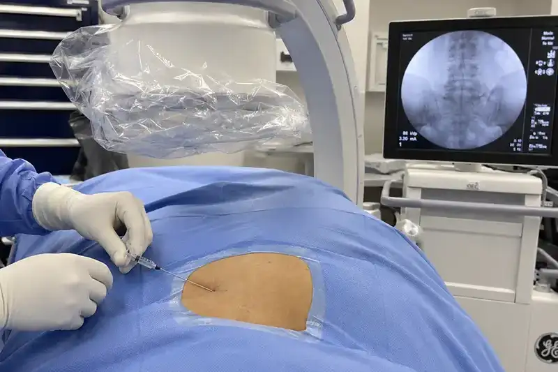 SI joint pain causing back or hip discomfort? Dr. Woska at Shore Spine & Pain in Lakewood and Shrewsbury, NJ offers targeted SI joint injections. Call today.