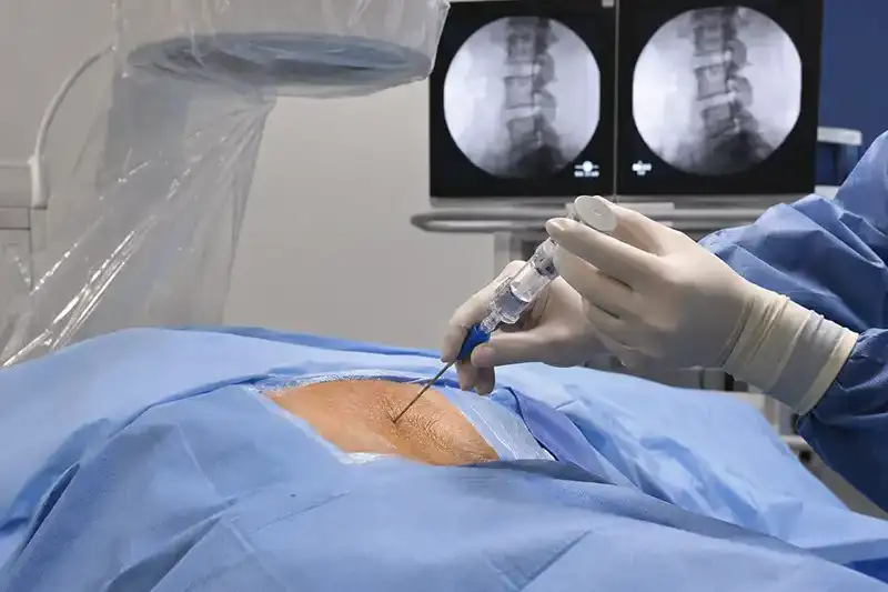 A physician holding an anatomical spine model and pointing to the intervertebral discs during a consultation at Shore Spine & Pain.